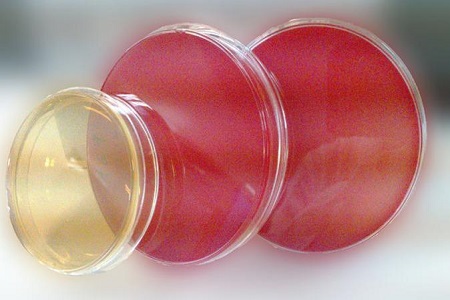 Salmonella Shigella Agar (SS): The Essential Medium for Pathogen Isolation