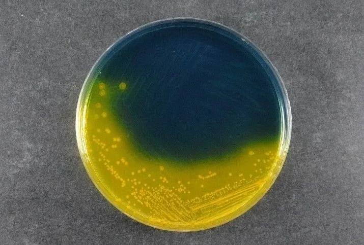 Ensuring Food Safety: Babio’s Salmonella Shigella Agar (SS) Supports Global Pathogen Detection Standards